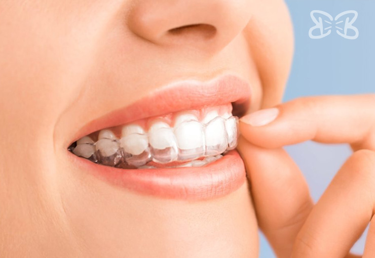 Dentistas en Puebla Biodental