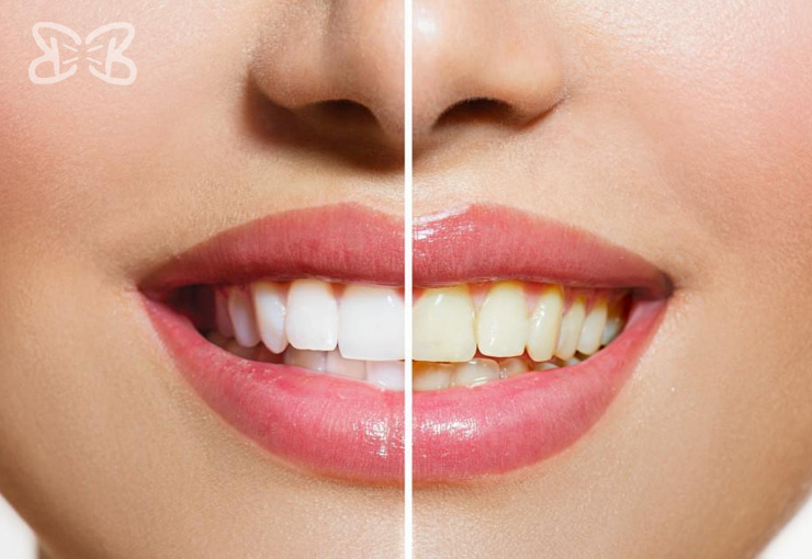 Dentistas en Puebla Biodental