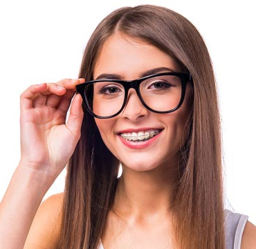 Brackets Estéticos