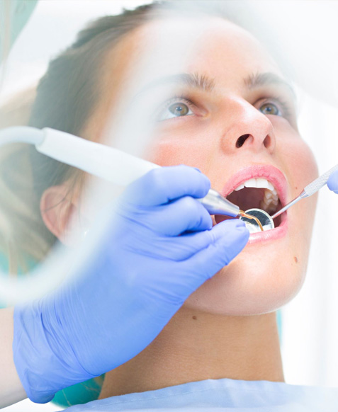 Servicios de Prevención Dental en Puebla