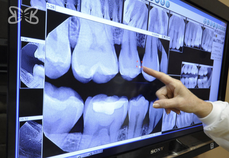 Dentistas en Puebla Biodental